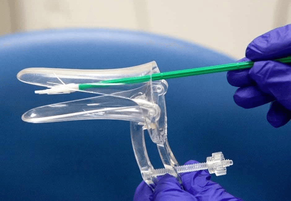 🌸 The Importance of Smear Tests 🌸